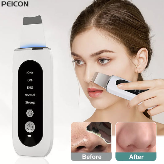 Ultrasonic Skin Scrubber Peeling Blackhead Remover Deep Face Cleaning Ultrasonic Ion Ance Pore Cleaner Facial Shovel Cleanser